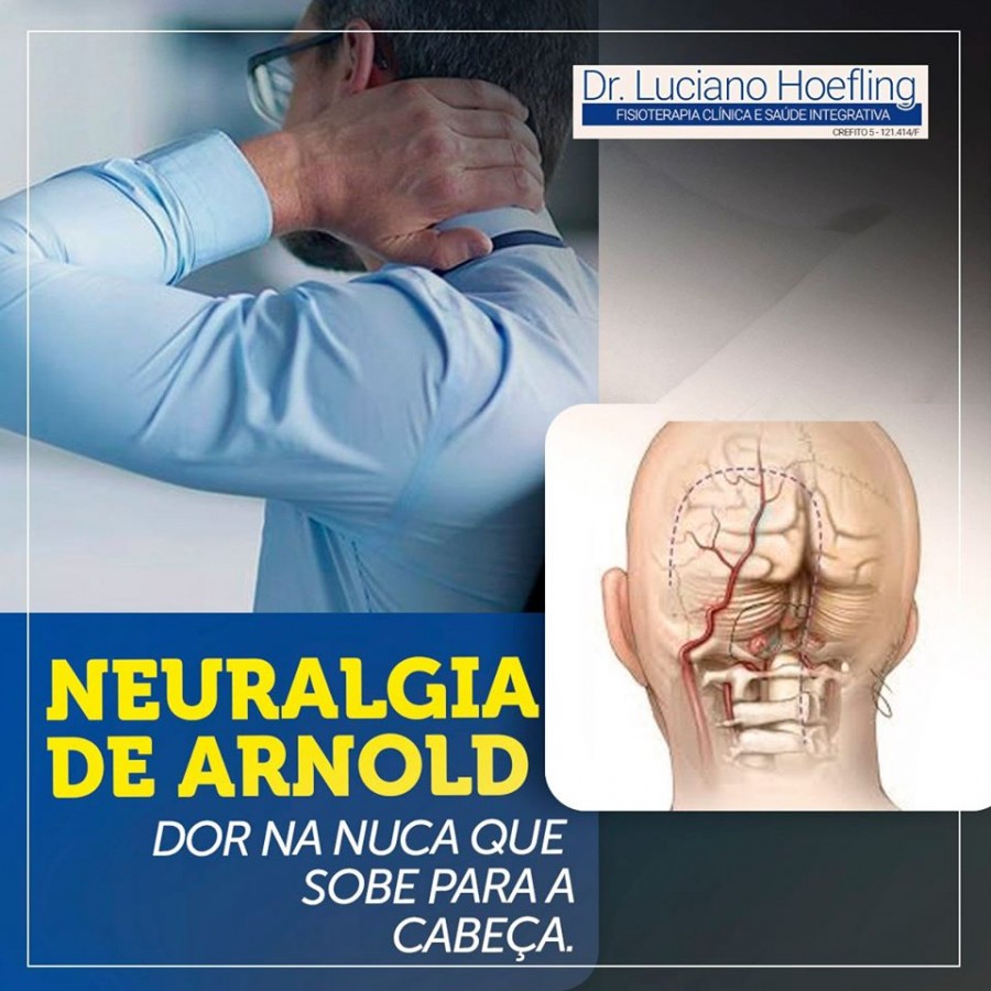 NEURALGIA DE ARNOLD