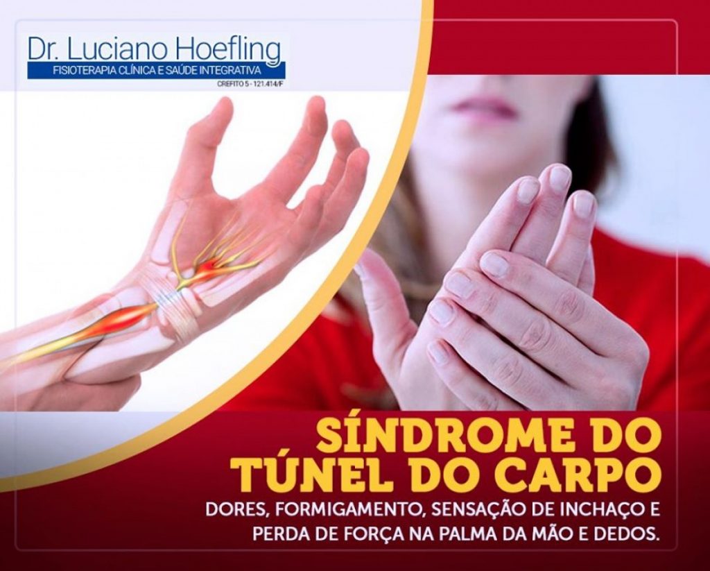 SINDROME DO TUNEL DO CARPO
