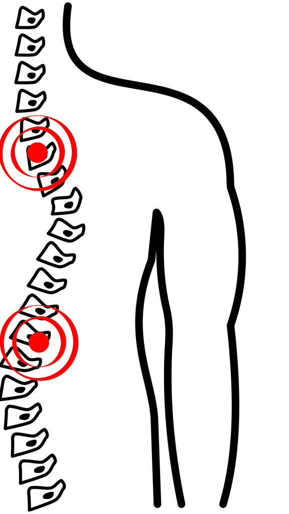 dor coluna pescoco fisioterapia