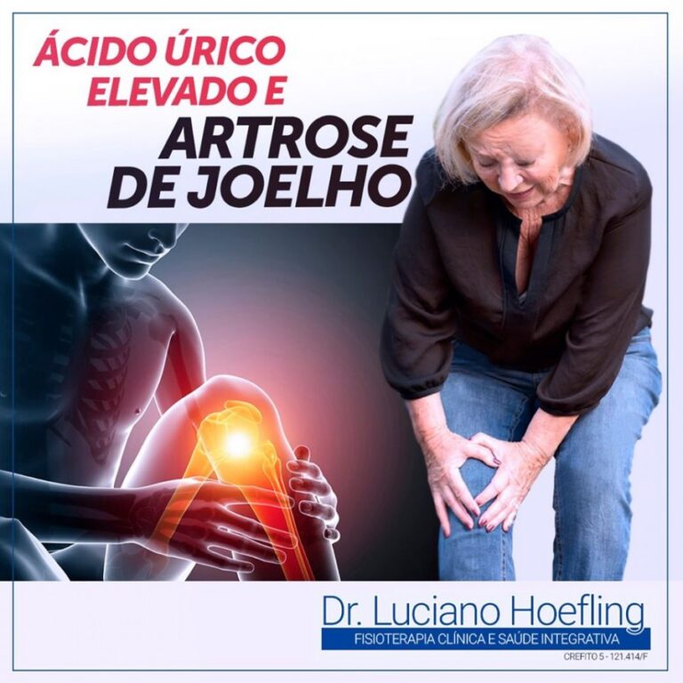 ACIDO URICO e Artrose de Joelho